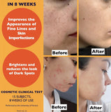 Big 2.11oz. Organic Vitamin C Serum for Face. Anti-Dark Spots, Wrinkles Skin Repair Serum with Hyaluronic Acid, Vitamin C & Niacinamide. All-in-One Brightening, Anti Aging Facial & Eye Area Skincare