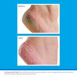 O'Keeffe's Healthy Feet 80ml