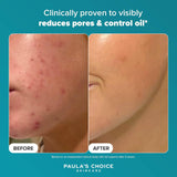 Paula's Choice SKIN PERFECTING 2% BHA Liquid Exfoliant - Face Exfoliating Peel Fights Blackheads & Enlarged Pores - for a Healthy Glow - with Salicylic Acid - Combination & Oily Skin - 30 ml