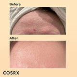 COSRX Advanced Snail 96 Mucin Power Essence 100ml, Skin Repair & Hydrating Serum, Snail Secretion Filtrate 96% & Hyaluronic acid, Korean Skincare, Animal testing free
